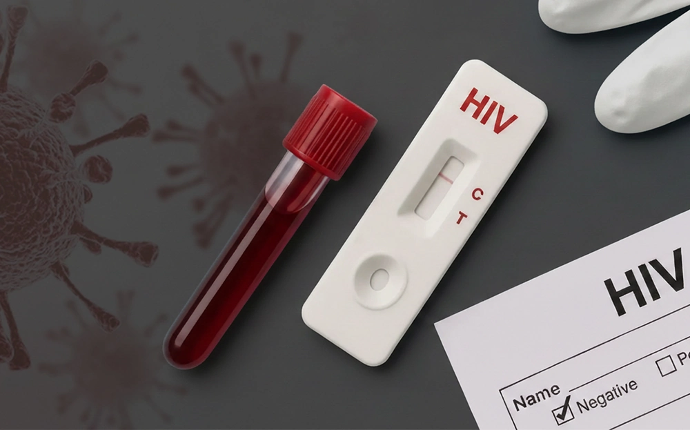 تشخیص ایدز بدون آزمایش