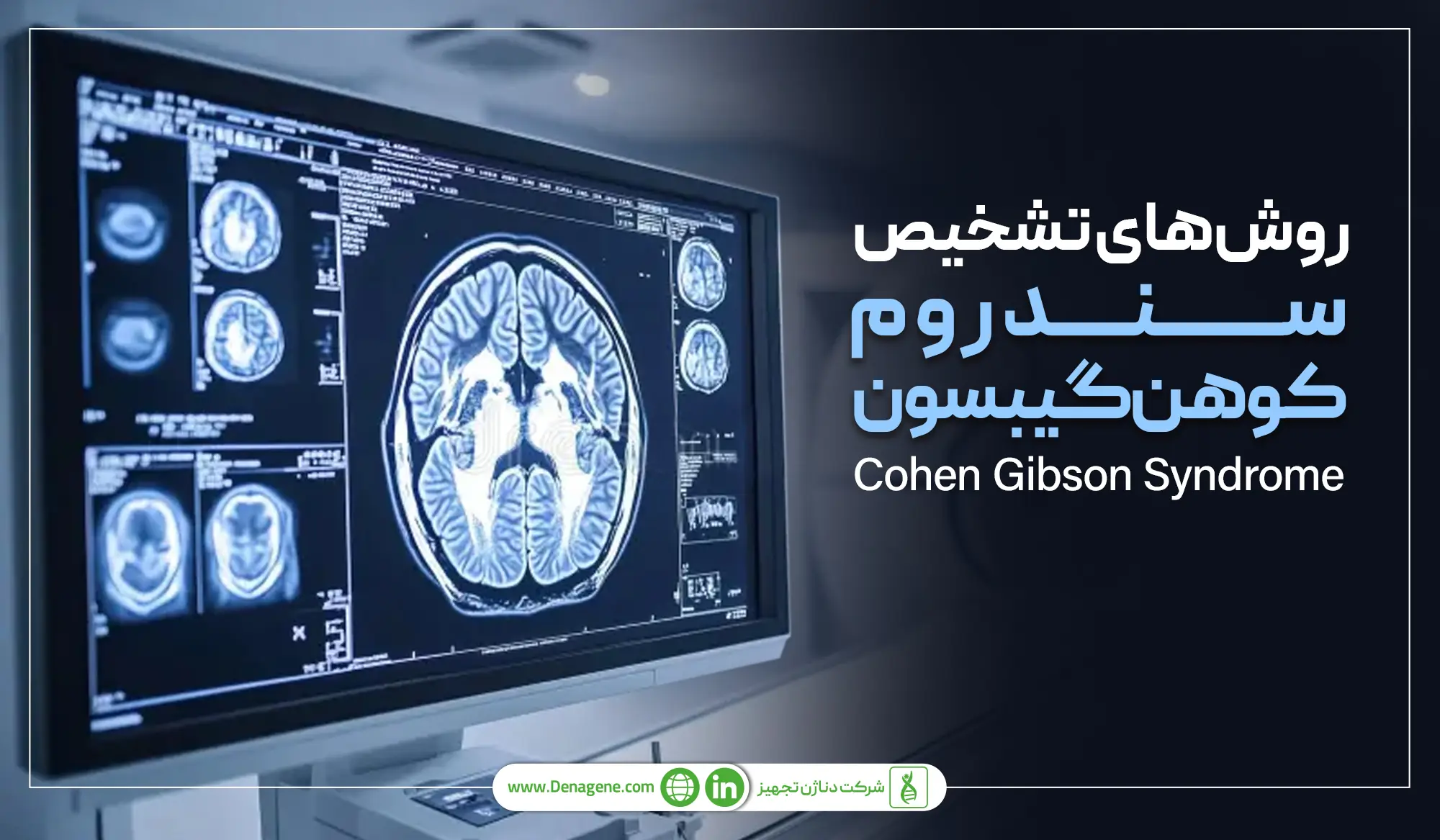 روش&zwnj;های تشخیص سندوم کوهن گیبسون